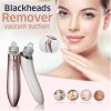 Blackhead remover vacuum pore cleaner