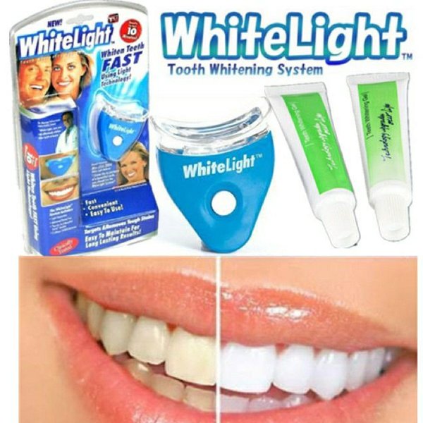 Ultra Light Technology For Whitening Teeth Or whitening Teeth Kit Ultra Light Technology For Whitening Teeth Or whitening Teeth Kit