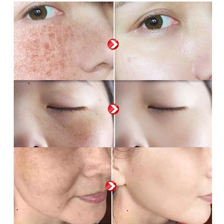 Dr Rashel Whitening Series Kit Dr Rashel Whitening Series Kit - Image 2