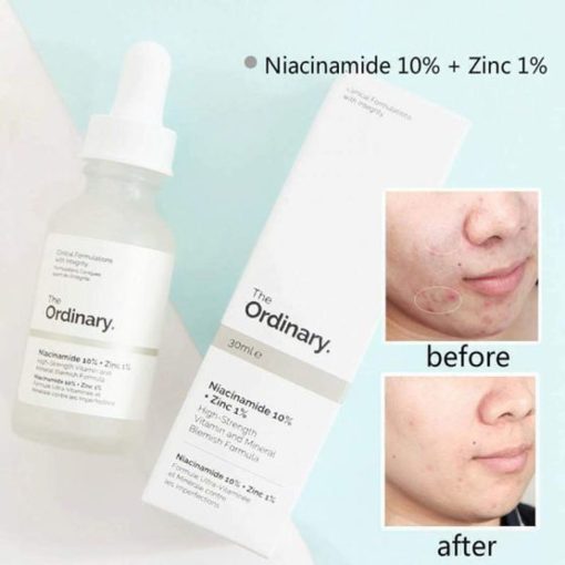 Niacinamide 10% Zinc 1% Brains Street, 44% OFF