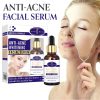 Aichun beauty Anti Acne Whitening Facial Serum 30 ML (3)