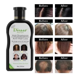 Bundle Offer Disaar Anti hair Loss Oil & Shampoo 200 ML