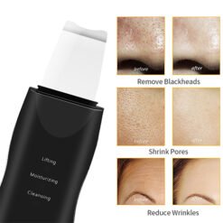 Deep Cleaning Vibrating Ultrasonic Skin Scrubber