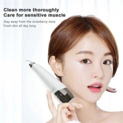Alternative view of Rechargable Blackhead Remover or Suction Extractor Facial Cleansing Skin Care with 6 Cups