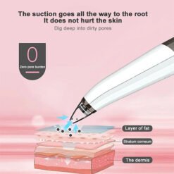 Rechargable Blackhead Remover or Suction Extractor Facial Cleansing Skin Care with 6 Cups