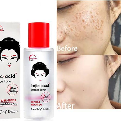 Kojic acid toner Repair & Brighting By Guanjing Beauty Kojic acid toner Repair & Brighting By Guanjing Beauty - Image 2
