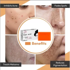 Kilarca Kojic Acid Skin Lightening Soap – Quick Whitening & Pigmentation Removal (120g)