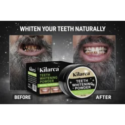 Kilarca Teeth Whitening Powder – 60g